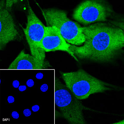Stathmin 1 Recombinant Rabbit mAb (SDT-383-4)