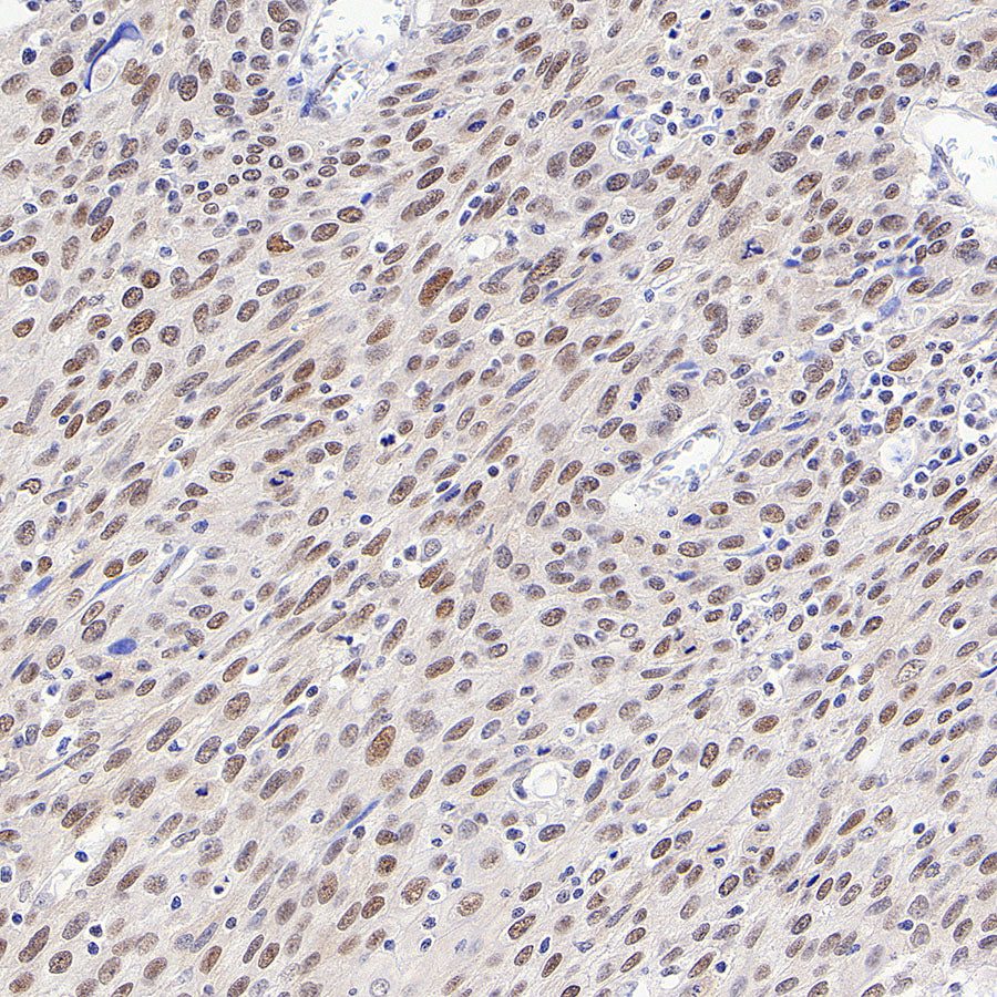 Chk2 Recombinant Rabbit mAb