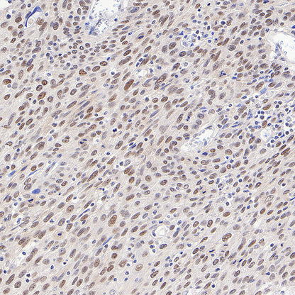 Chk2 Recombinant Rabbit mAb