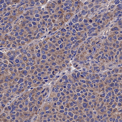 TOM70 Mouse mAb
