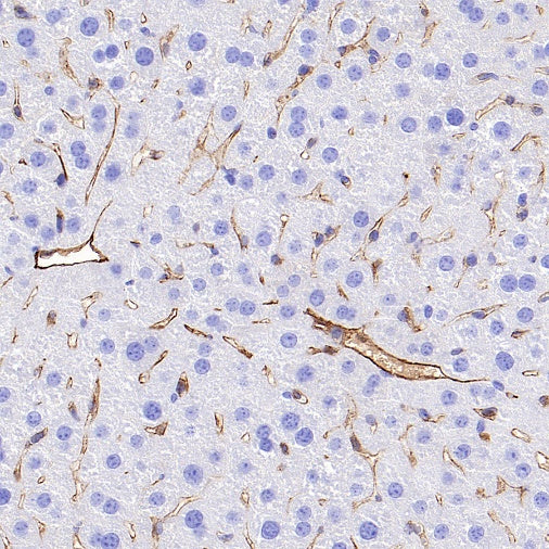 CD31 Recombinant Rabbit mAb (S-R568)