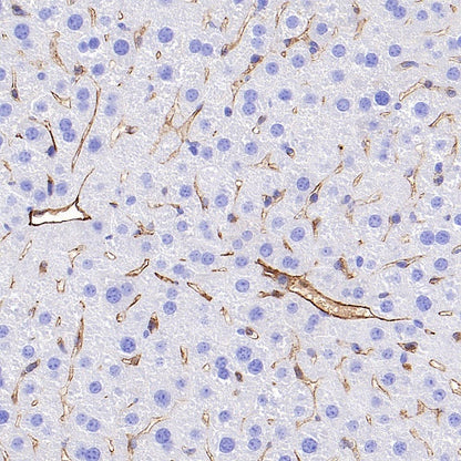 CD31 Recombinant Rabbit mAb (S-R568)