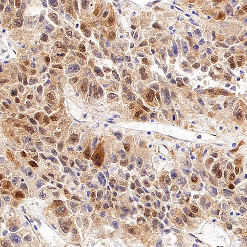 BAG3 Recombinant Rabbit mAb (S-1837-22)