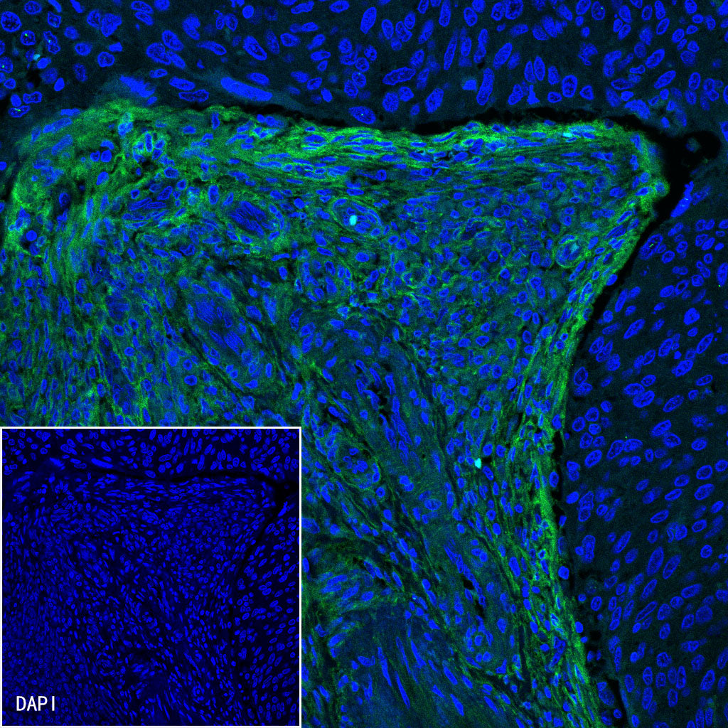 PDGFRA+PDGFRB Recombinant Rabbit mAb (S-393-11)