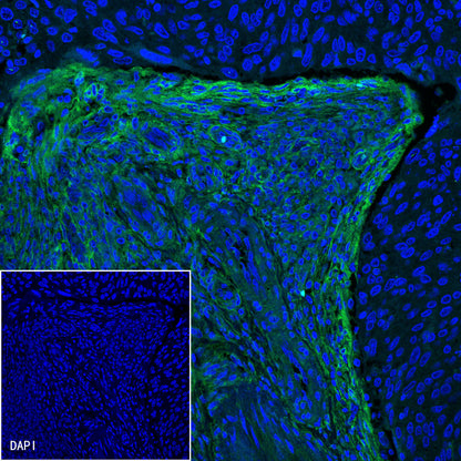 PDGFRA+PDGFRB Recombinant Rabbit mAb (S-393-11)