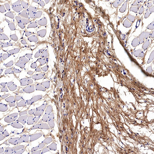 Collagen III Recombinant Mouse mAb (S-3838)