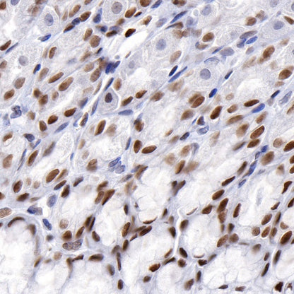 JunB Recombinant Rabbit mAb (S-R294)