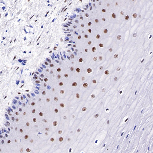Estrogen Receptor α Recombinant Rabbit mAb (SDT-R371)