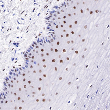 Estrogen Receptor α Recombinant Rabbit mAb (SDT-R371)