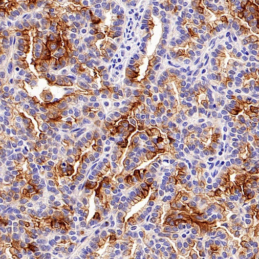 TIM-1 Recombinant Rabbit mAb (S-1555-147)