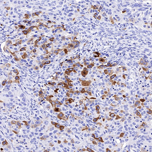 TACC3 Recombinant Rabbit mAb (S-3048-50)