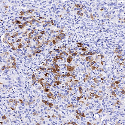 TACC3 Recombinant Rabbit mAb (S-3048-50)
