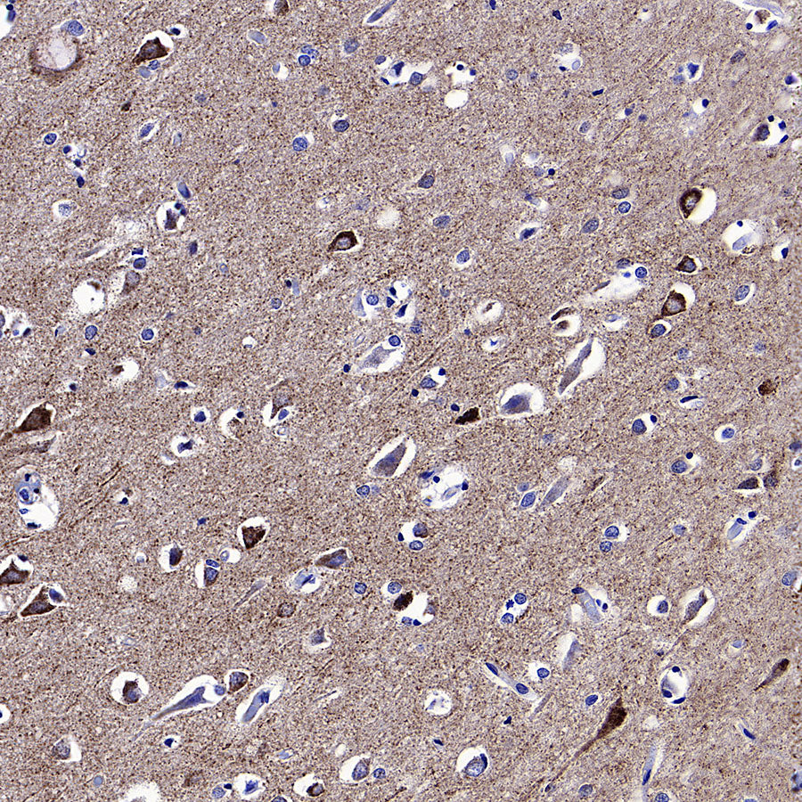 WWP1 Recombinant Rabbit mAb (S-4412-25)