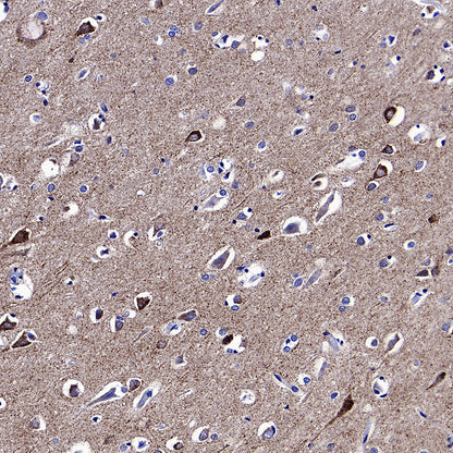 WWP1 Recombinant Rabbit mAb (S-4412-25)