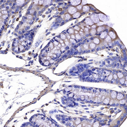 ROCK2 Rabbit Polyclonal Antibody