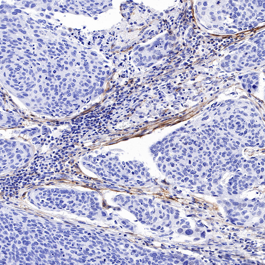 FAP Recombinant Rabbit mAb,PBS Only (SDT-R132)