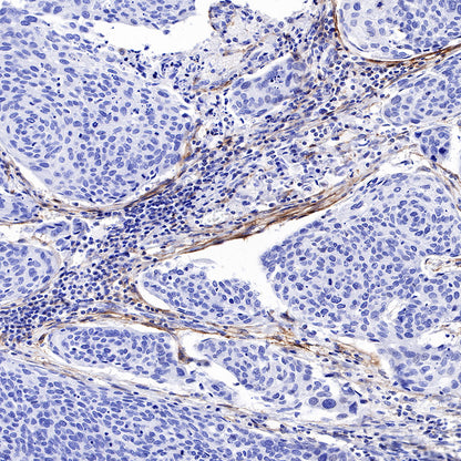 FAP Recombinant Rabbit mAb,PBS Only (SDT-R132)