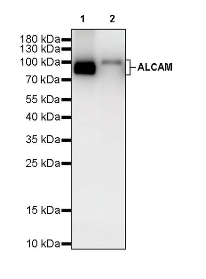 ALCAM Recombinant Rabbit mAb (S-4080-40)