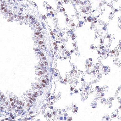 p27 Recombinant Rabbit mAb (SDT-R350)