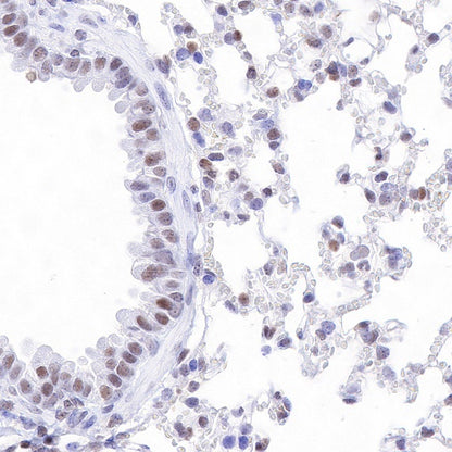 p27 Recombinant Rabbit mAb (SDT-R350)