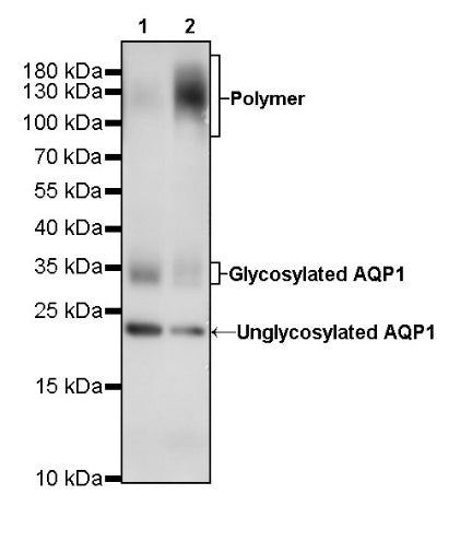 Aquaporin 1/AQP1 Recombinant Rabbit mAb (S-794-79)