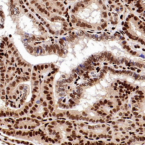 SAMHD1 Recombinant Rabbit mAb (S-2401-25)