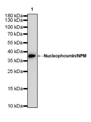 Nucleophosmin/NPM Recombinant Rabbit mAb (S-R231)