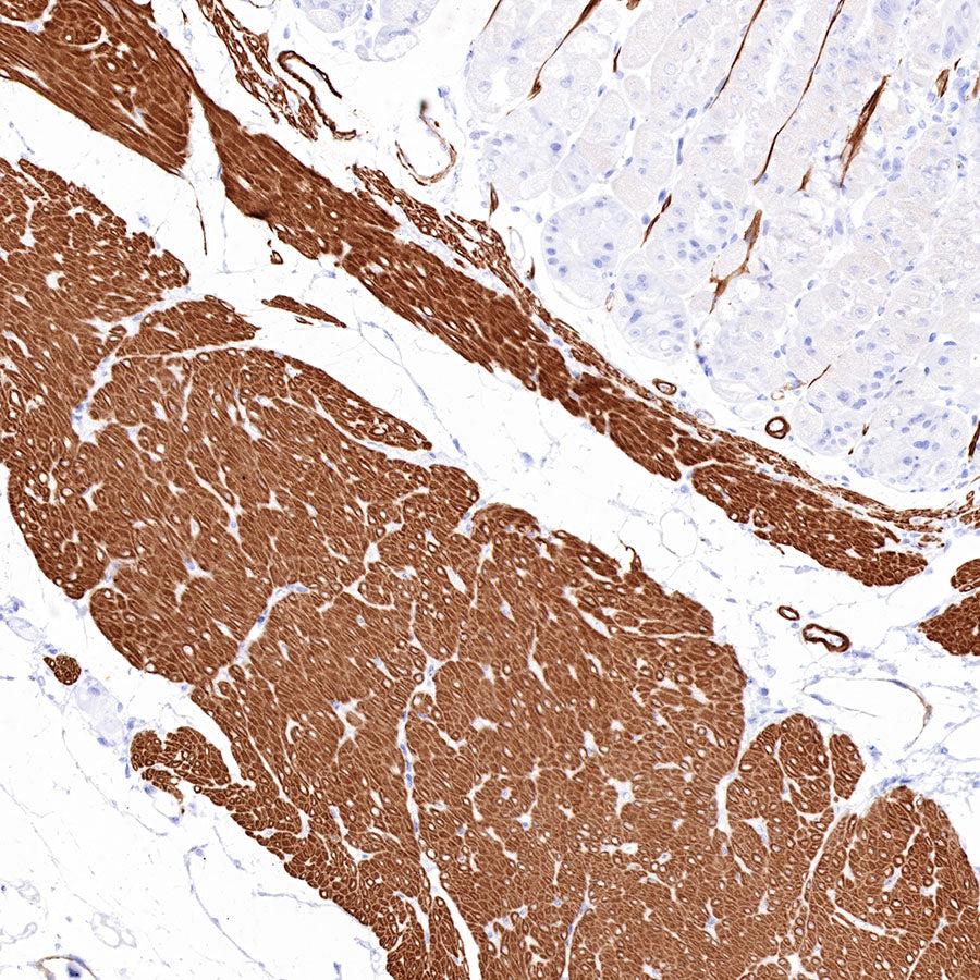 Smooth Muscle Myosin Heavy Chain (SMMHC) Recombinant Rabbit mAb (SDT-R089)