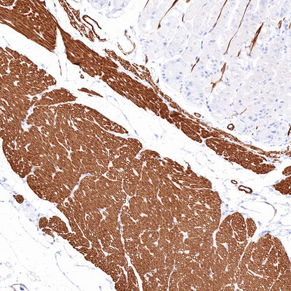 Smooth Muscle Myosin Heavy Chain (SMMHC) Recombinant Rabbit mAb (SDT-R089)