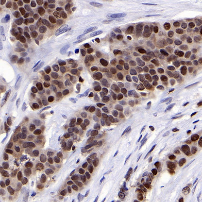 PDCD4 Rabbit polyclonal antibody