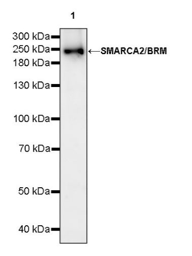 SMARCA2/BRM Recombinant Rabbit mAb (S-1568-17)