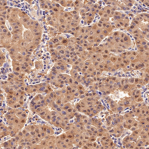 Superoxide Dismutase 1 Recombinant Rabbit mAb (S-1537-39)