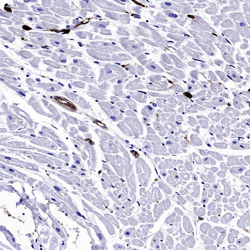 CD61 Recombinant Rabbit mAb (S-2515-6)