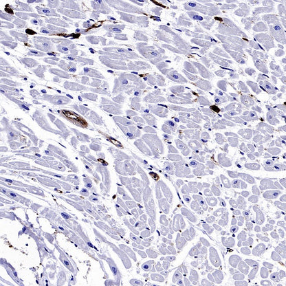CD61 Recombinant Rabbit mAb (S-2515-6)
