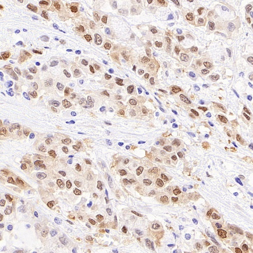 Phospho-YAP (Ser127) Recombinant Rabbit mAb (S-4250)