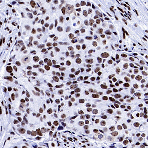 PELP1 Recombinant Rabbit mAb (S-756-22)