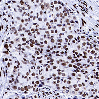 PELP1 Recombinant Rabbit mAb (S-756-22)