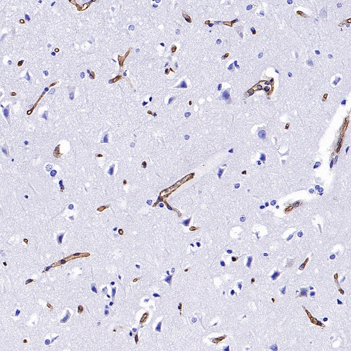 PODXL Recombinant Rabbit mAb (S-2014-9)