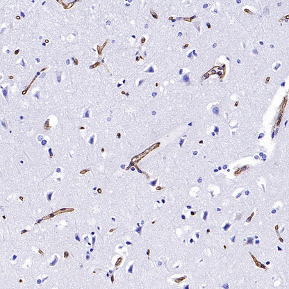 PODXL Recombinant Rabbit mAb (S-2014-9)