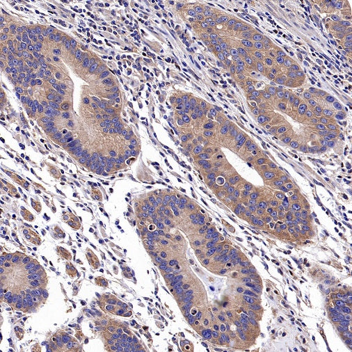 c-IAP2 Recombinant Rabbit mAb (S-3395)