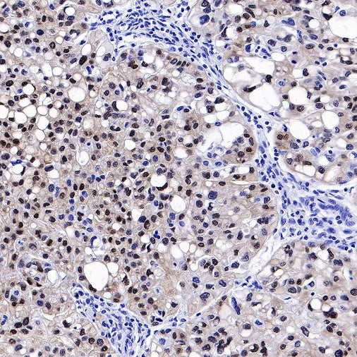Brachyury Recombinant Rabbit mAb (SDT-1926-107)