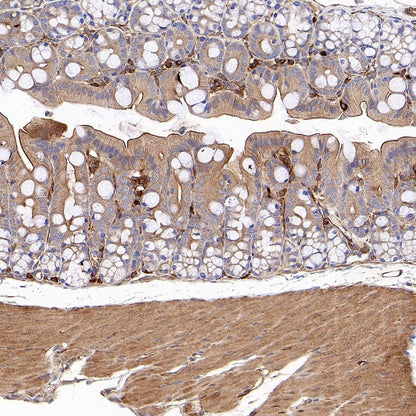 Vinculin Recombinant Rabbit mAb (S-1635-3)