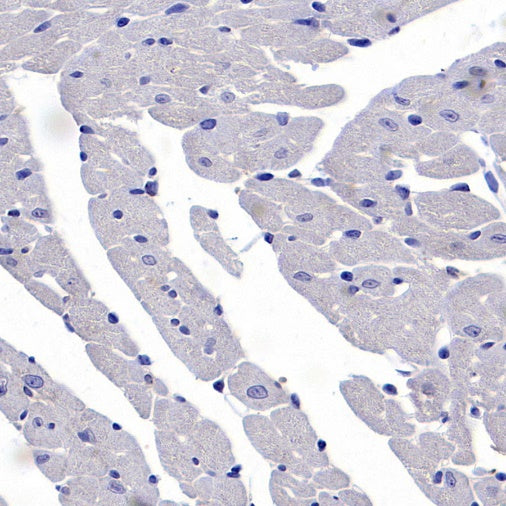 Human Cytoplasmic Marker Recombinant Mouse mAb (SDT-2921)