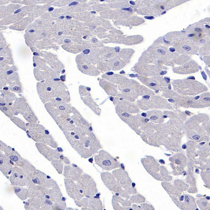 Human Cytoplasmic Marker Recombinant Mouse mAb (SDT-2921)