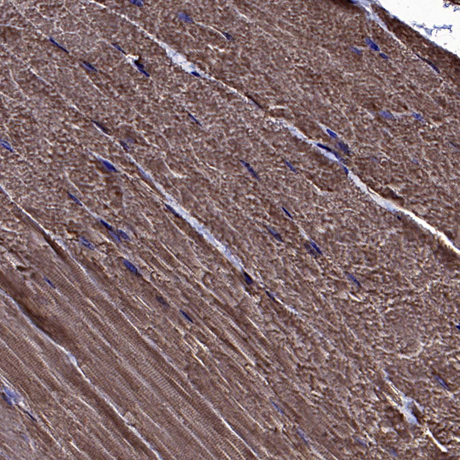 BIN1 Recombinant Rabbit mAb (S-4287-18)