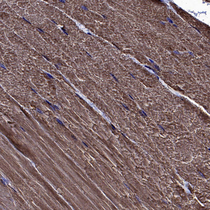 BIN1 Recombinant Rabbit mAb (S-4287-18)