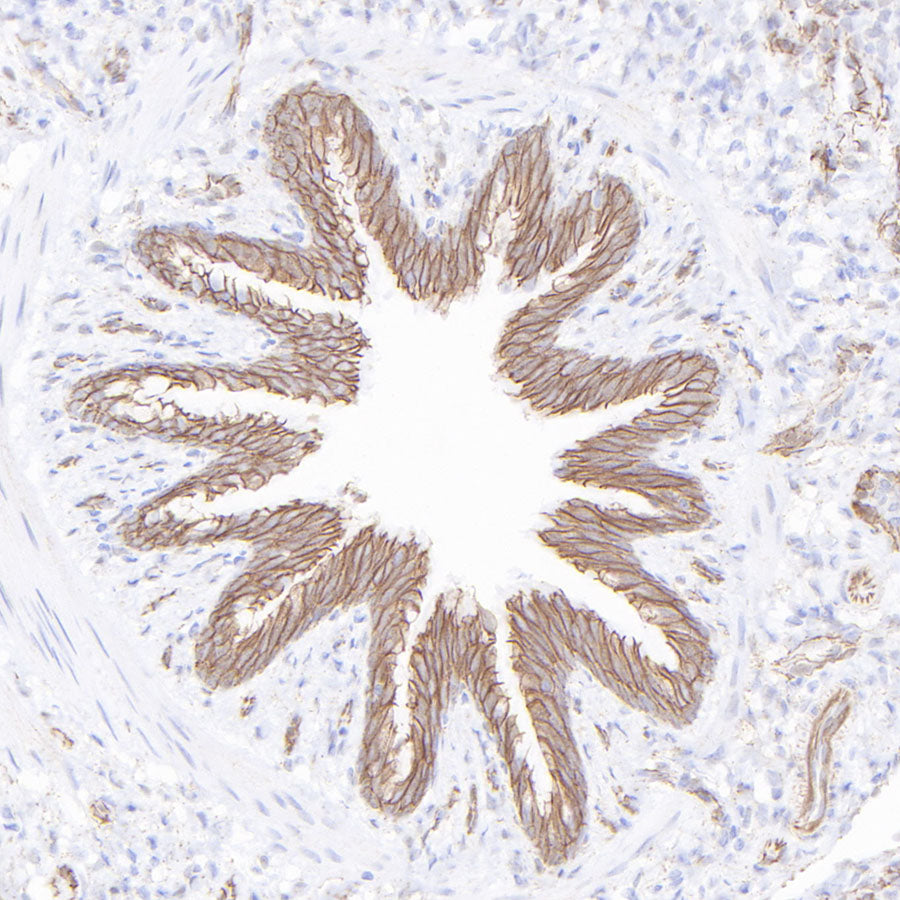 β-Catenin Recombinant Rabbit mAb,PBS Only (SDT-336-23)