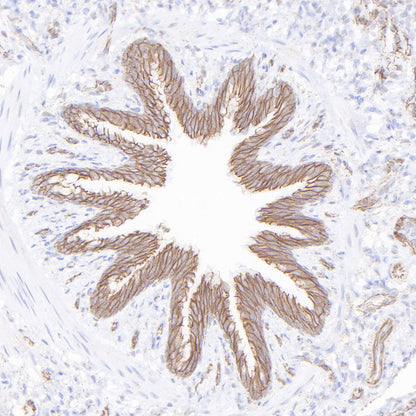 β-Catenin Recombinant Rabbit mAb,PBS Only (SDT-336-23)