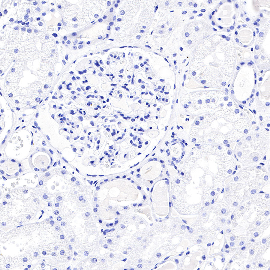 CGA/HCG-α Recombinant Rabbit mAb (SDT-227-66)