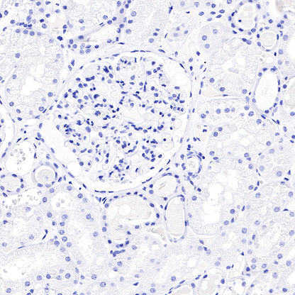 CGA/HCG-α Recombinant Rabbit mAb (SDT-227-66)